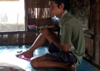 Meski Tunanetra Rozali Warga Sukamenang Gelumbang Tetap Semangat Mengais Rezeki Dari Jasa Pijat