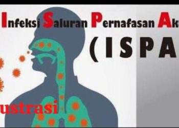 Kasus ISPA di Gelumbang Meningkat, Imbas Asap Karhutla 