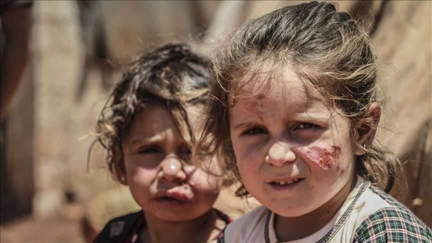 WHO Terus Perangi Penyakit Endemik Visceral Leishmaniasis