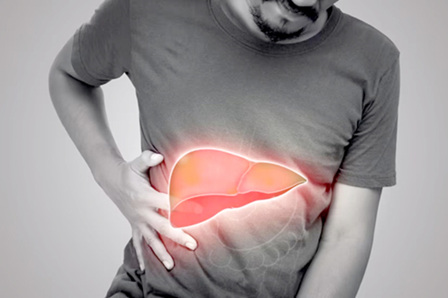 Hepatitis Masih Jadi Epidemi Diam di Indonesia, Kenali Gejalanya