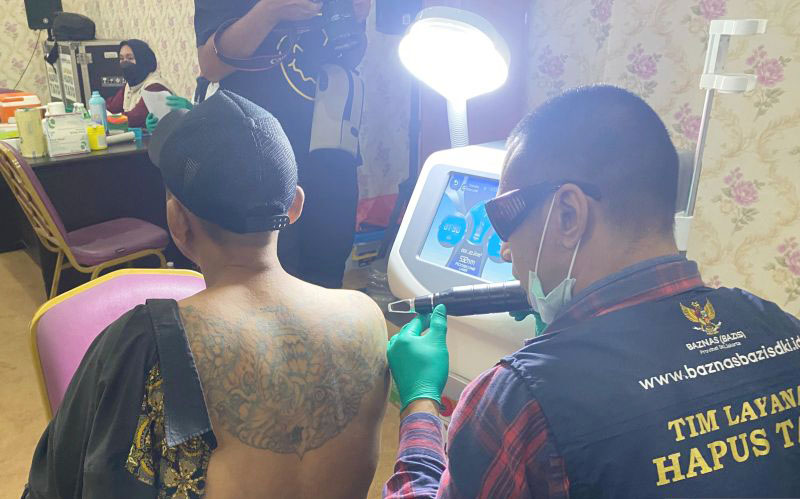 Hapus Tato Gratis Lewat Baznas DKI dan RSUD Kebayoran Lama