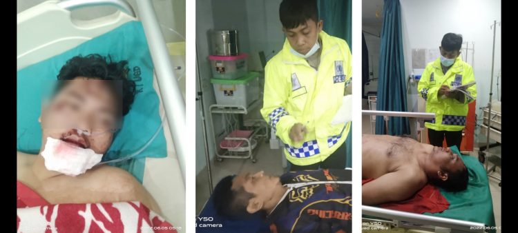 Ke tiga pria mengalami luka luka mendapatkan perawatan medis di rumah sakit