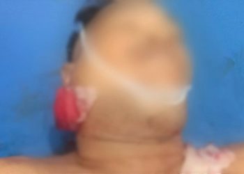 Jenajah Nasib diduga bandar narkoba tewas ditembak. (Foto Ist)