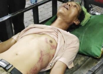 Ahmad Firdaus korban dianiaya oknum Baja Dit Samapta Polda Sumut. (Foto Ist)