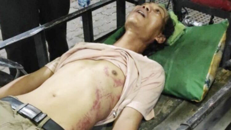 Ahmad Firdaus korban dianiaya oknum Baja Dit Samapta Polda Sumut. (Foto Ist)