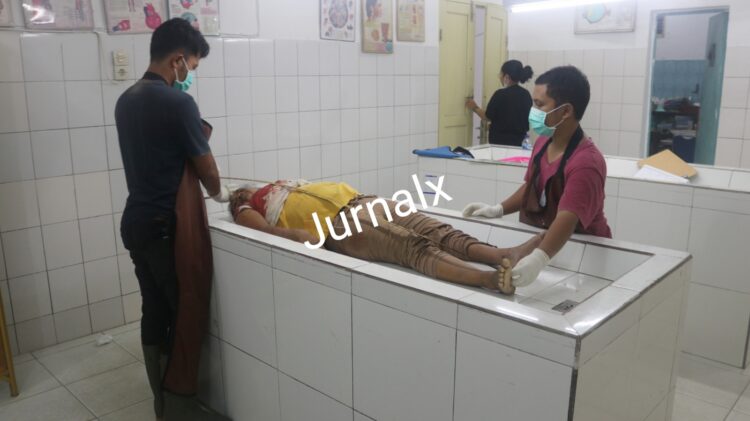 Jenajah Afrida Sarih penumpang sepeda motor Yamaha Mio BK 4348-AAW saat di visum Tim Forensik RSUD dr Djasamen Saragih Kota Siantar