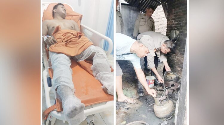 Gamot Giar Tirza Pamungkas mengalami luka bakar dan personil Polsek Perdagangan saat olah TKP