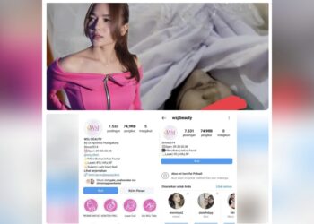 Ella Nanda Sari Hasibuan yang meninggal setelah menjalani sedot lemak di Klinik WSJ Beauty, Depok dan akun medsos WSJ Beauty privat. (Foto Ist)