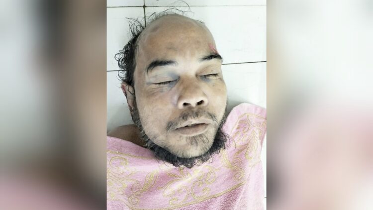 Jenajah pria bertato pedang ditangan kiri