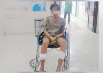 Pelaku curanmor, Irman Syahputra yang dua kakinya ditembus peluru oleh polisi. (Foto Ist)