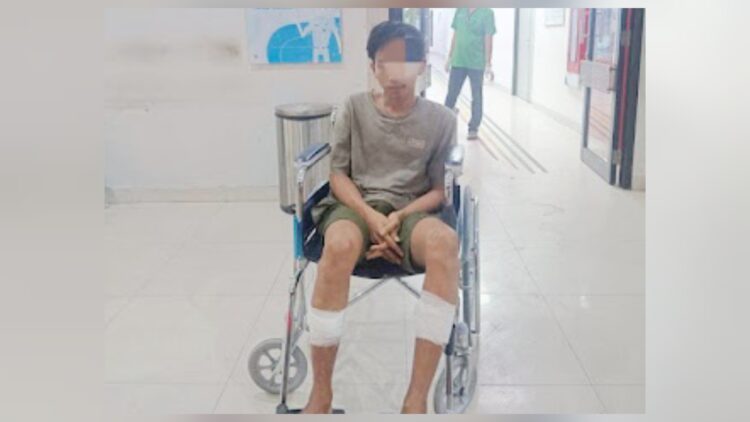 Pelaku curanmor, Irman Syahputra yang dua kakinya ditembus peluru oleh polisi. (Foto Ist)