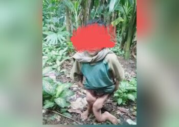 Bocah perempuan berusia 10 tahun yang diduga disiksa. (Foto Ist)