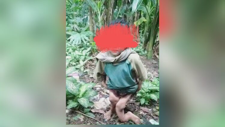 Bocah perempuan berusia 10 tahun yang diduga disiksa. (Foto Ist)