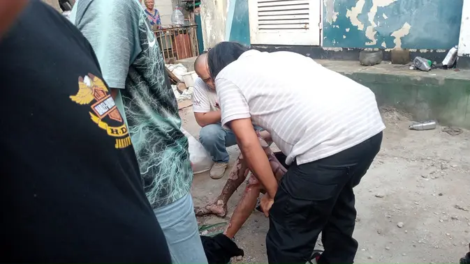 Pria Diduga Curi Kabel Tersengat Listrik hingga Luka Bakar 70 Persen
