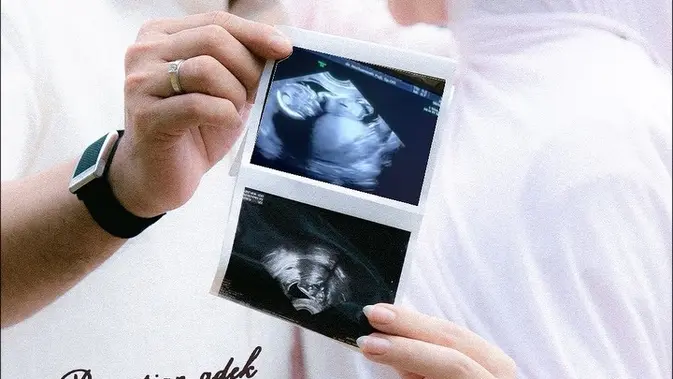 Irish Bella dan Hady Sabri: Momen Mengharukan di Balik Maternity Shoot
