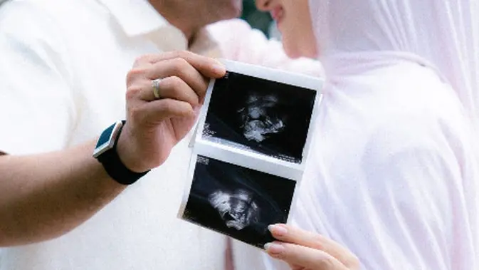 Penantian Manis Irish Bella: Kabar Bahagia dalam Balutan Pastel