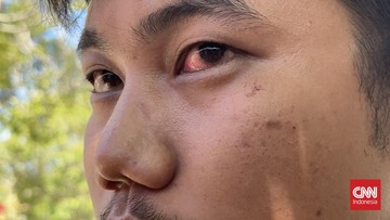 BREAKING: Direskrimum Polda Sumbar Aniaya Pengendara, Diselidiki