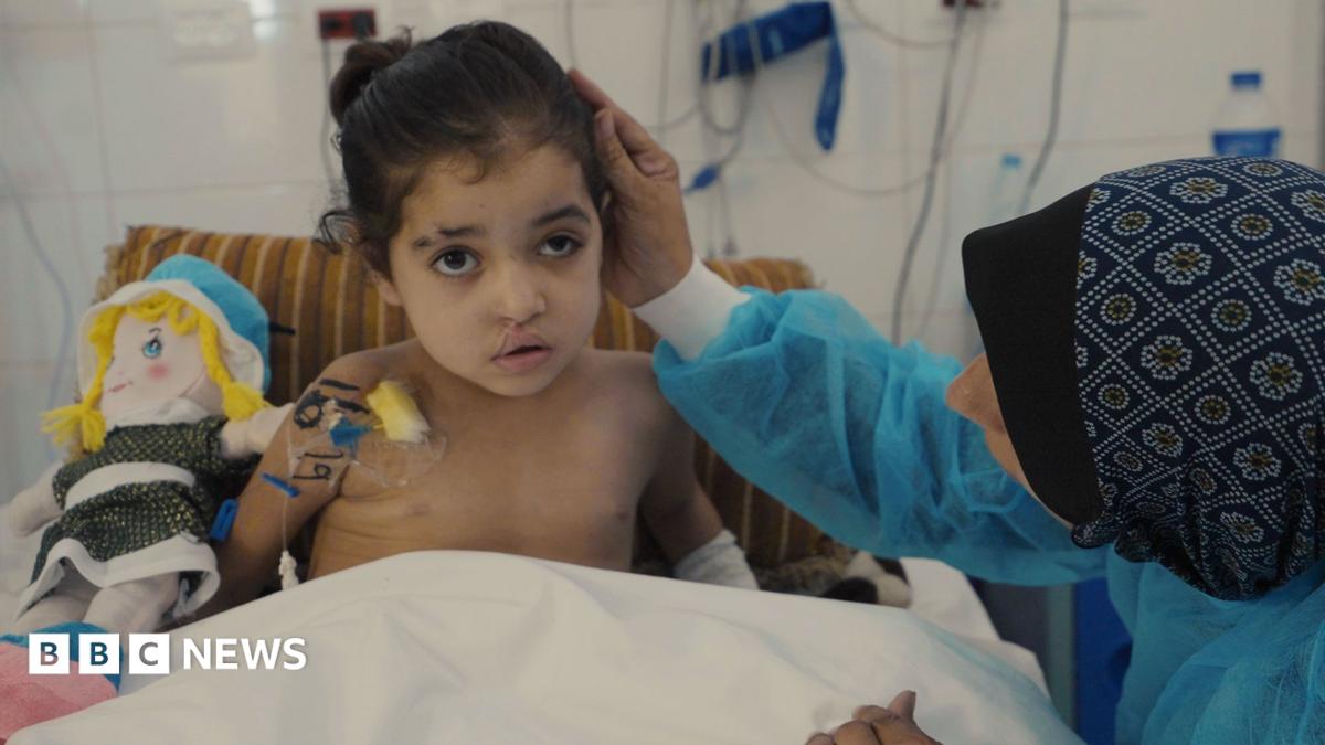Gaza girl, 6, endures more than 20 surgeries as wounds become infected after strike on tent camp