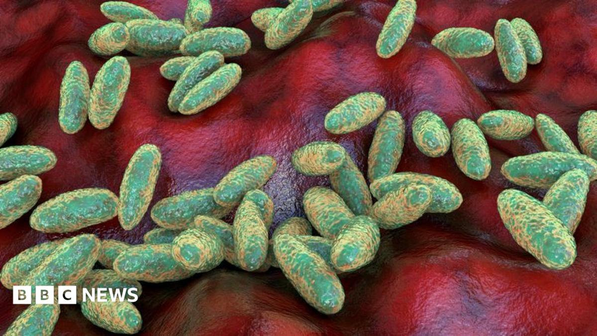 Explained: What Pneumonic Plague Is, How It Spreads, and Why a Siberian Lab Death Has Drawn Global Attention