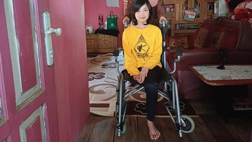 Harapan Kaki Palsu Anak Pemetik Teh demi Sekolah Kembali