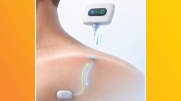 Stop Kontak Bawah Kulit Siap Uji Klinis pada Manusia