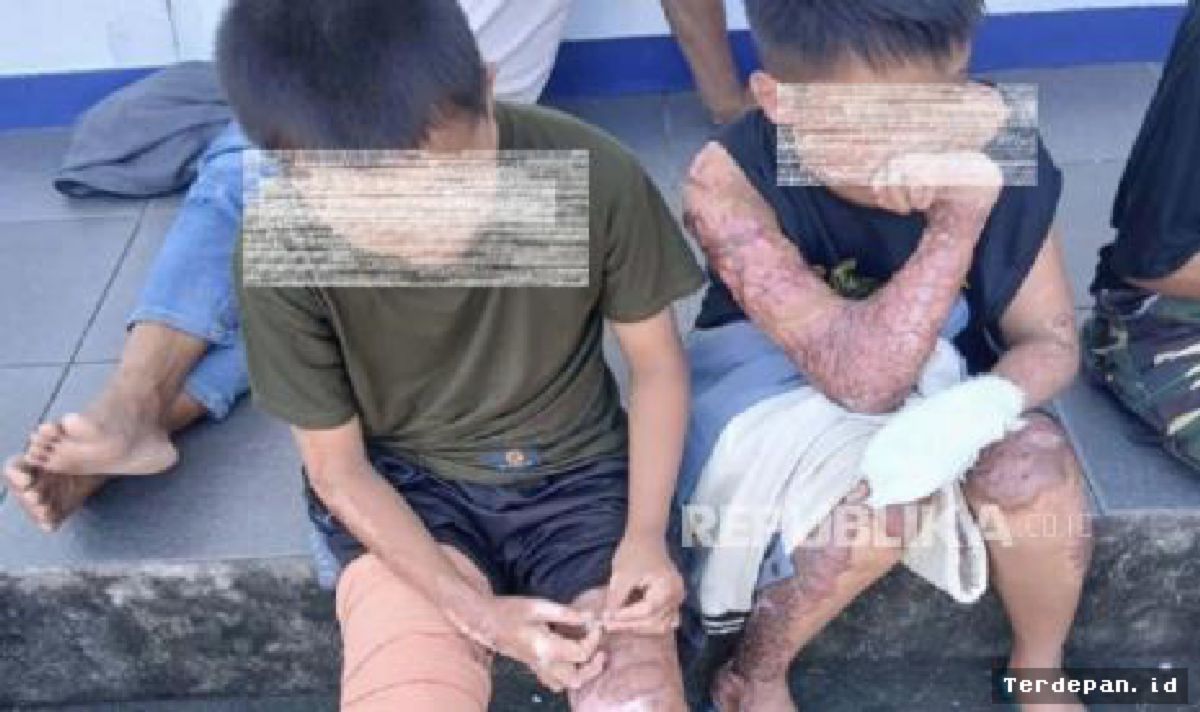 Lombok Tengah — Setahun Kasus Santri Dibakar, Polisi Dalami Dugaan Kelalaian
