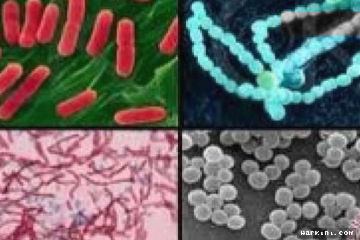 CDC Laporkan Wabah Salmonella Serang 22 Warga di Empat Negara Bagian AS