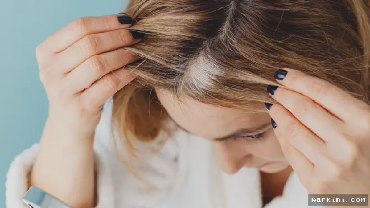 JAKARTA — Dermatolog Bagikan Panduan Merawat Rambut Berketombe Tetap Lembap