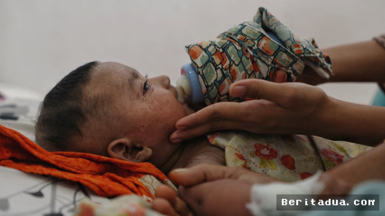 BANGLADESH — Wabah Campak Terburuk Tewaskan 1.000 Anak dalam Enam Bulan