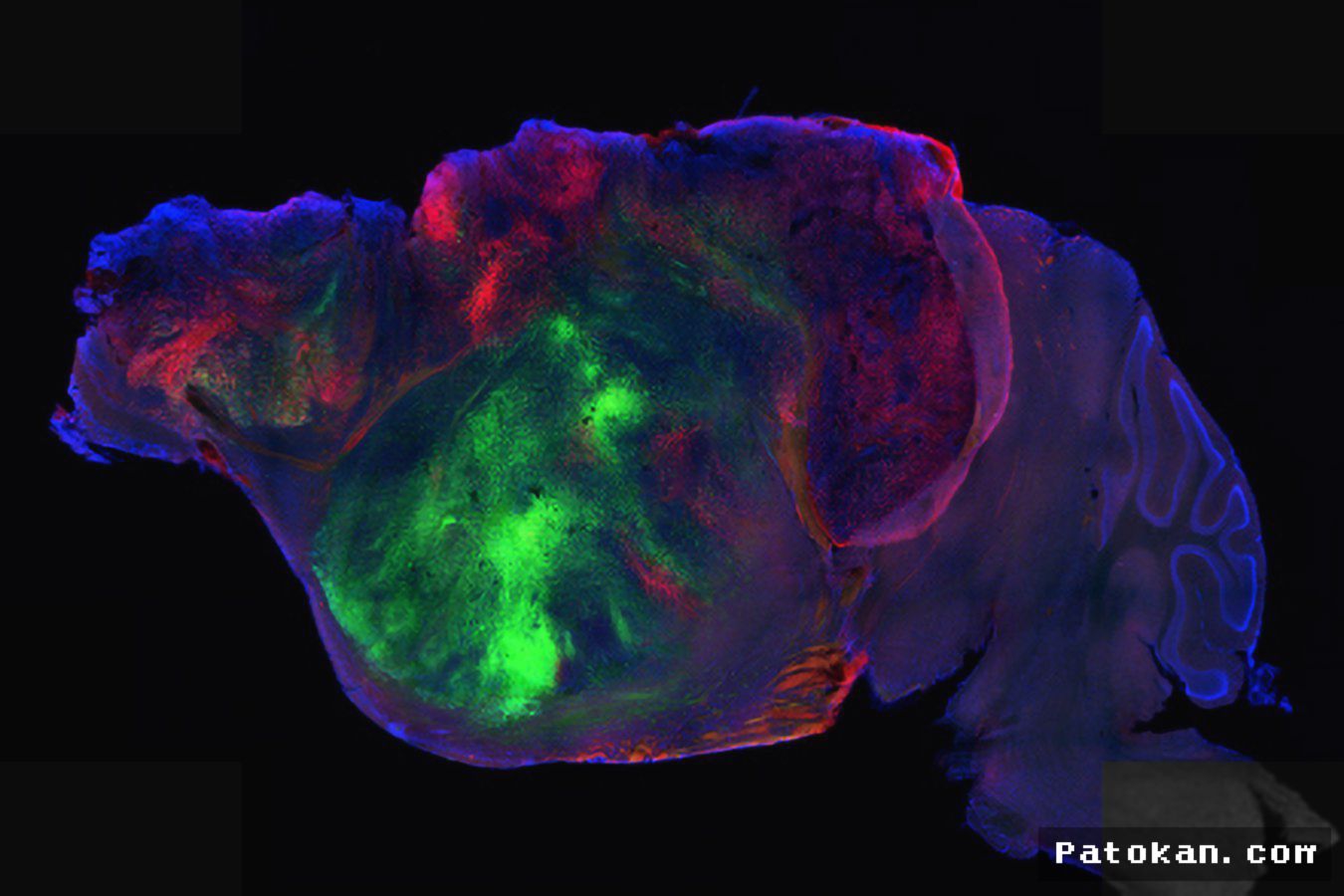 Organoid Otak Manusia Berhasil Pulihkan Kognisi Tikus Berefisiensi Otak