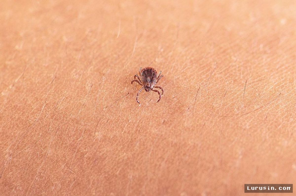 Peneliti AS Temukan Virus Baru pada Spesies Kutu Invasif Berbahaya