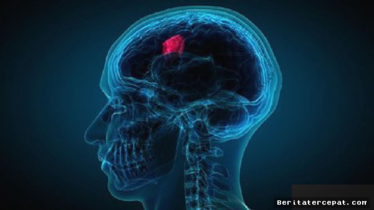 Peneliti Manchester Deteksi Tumor Otak Lewat Sampel Air Mata