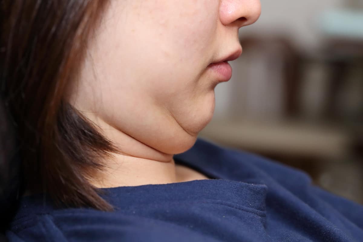 Cara Menghilangkan Double Chin Secara Alami: Cantiks Wajib Coba Tips Paling Ampuh Ini!