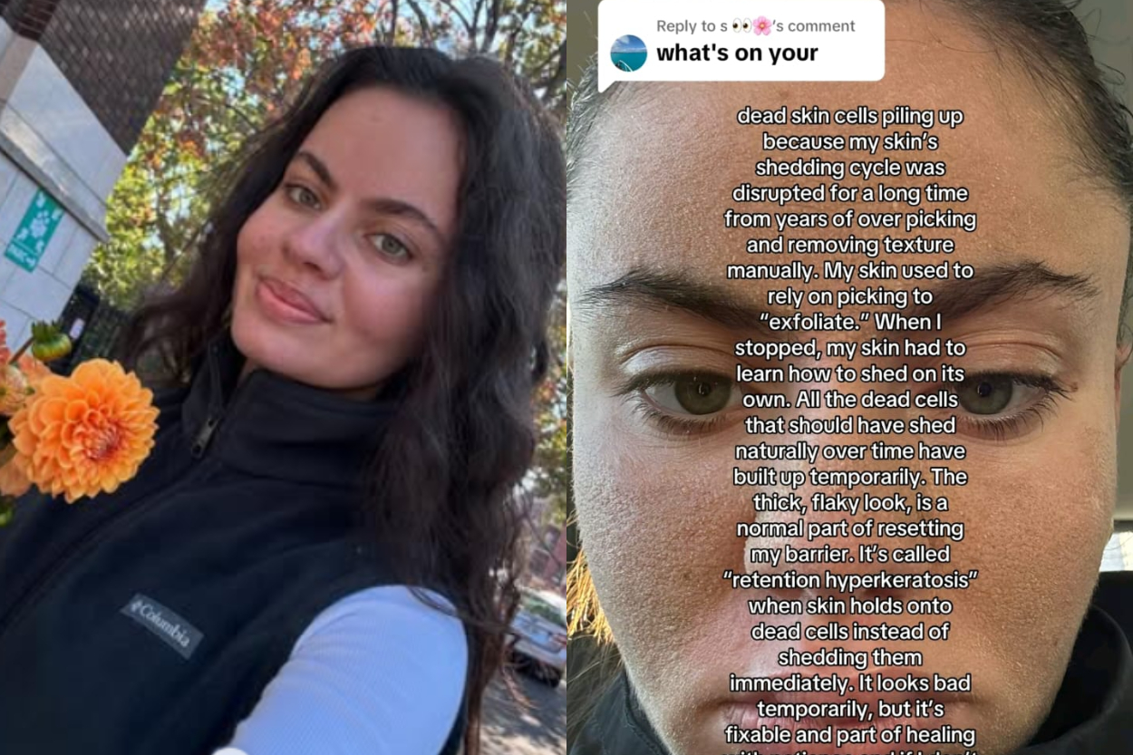 Viral Tren Skincare Ekstrem Caveman Method di TikTok, Tak Cuci Muka Tak Pakai Skincare, Apakah Bahaya?