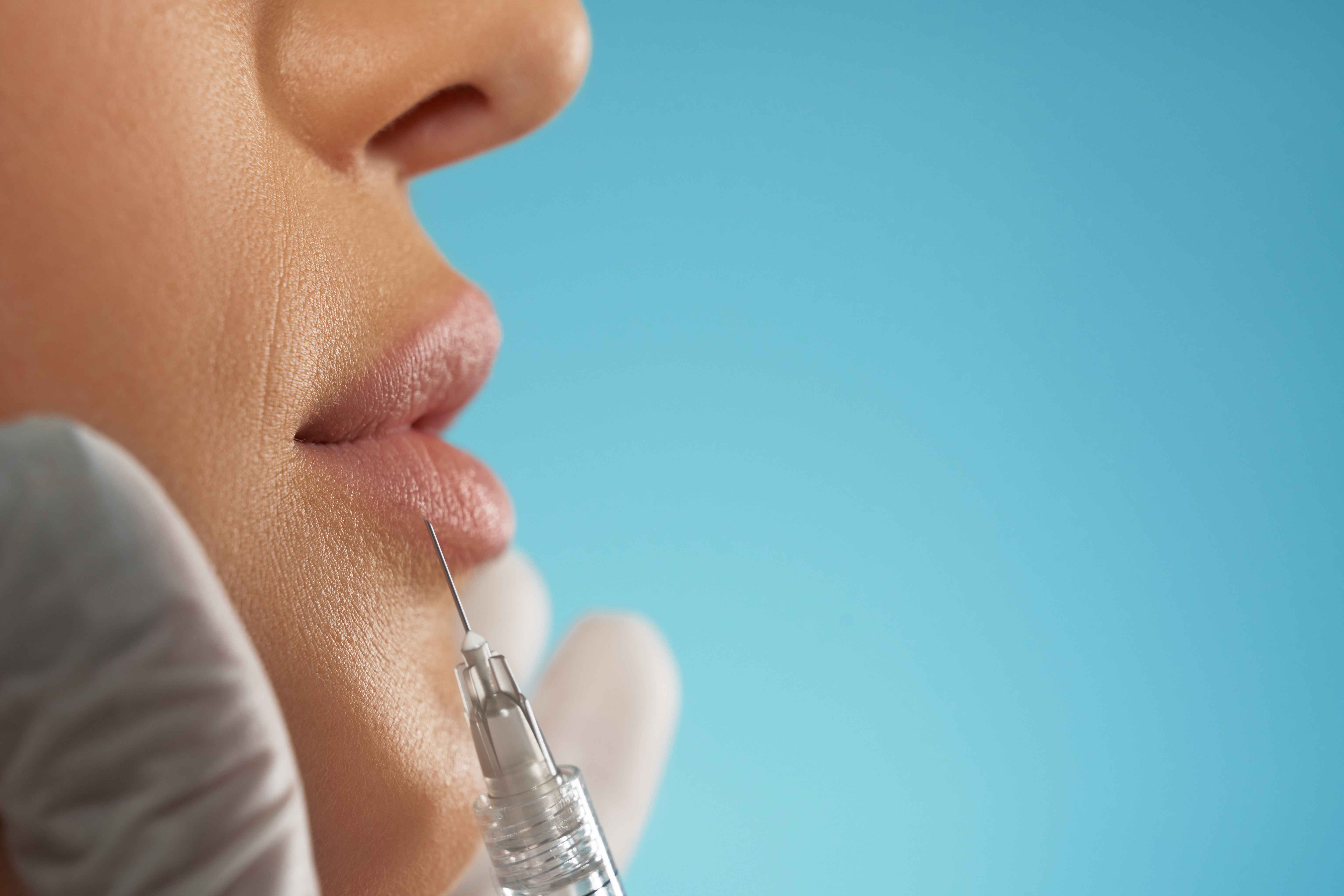 Bak Ariel Tatum, 10 Hal Yang Wajib Diketahui Sebelum Melakukan Lip Filler