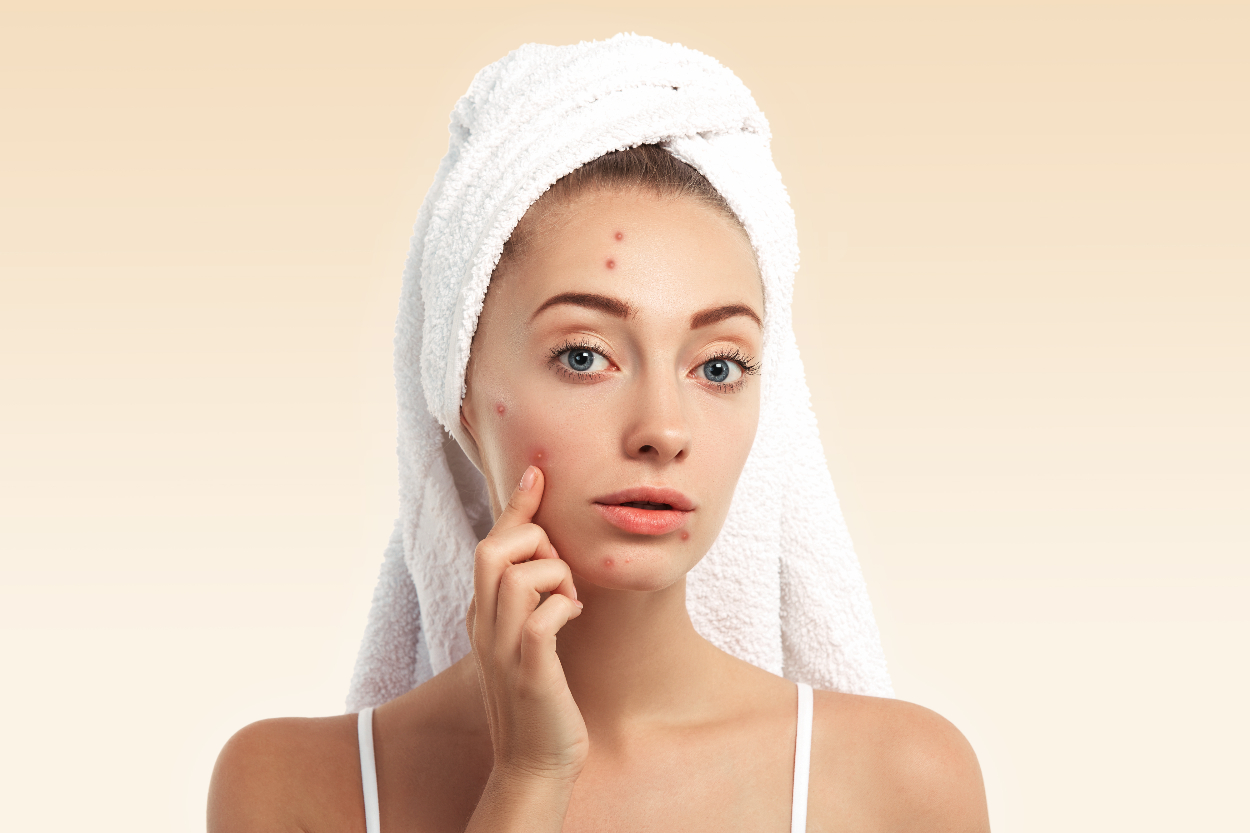Tren Kecantikan Ala TikTok: Lemak Sapi untuk Skincare, Beneran Aman atau Picu Jerawat?