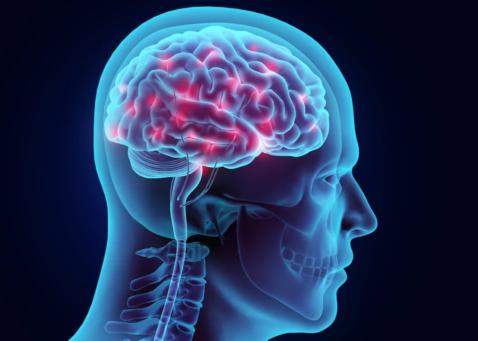 Gawat! Alzheimer Ternyata B...