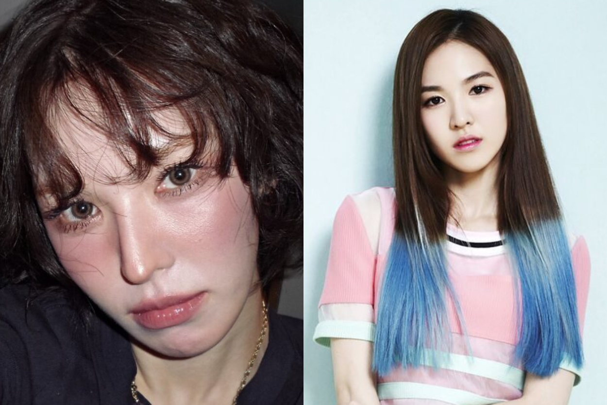 Viral Perubahan Wajah Wendy Red Velvet! Netizen Bingung, Operasi Plastik atau Efek Kecelakaan?