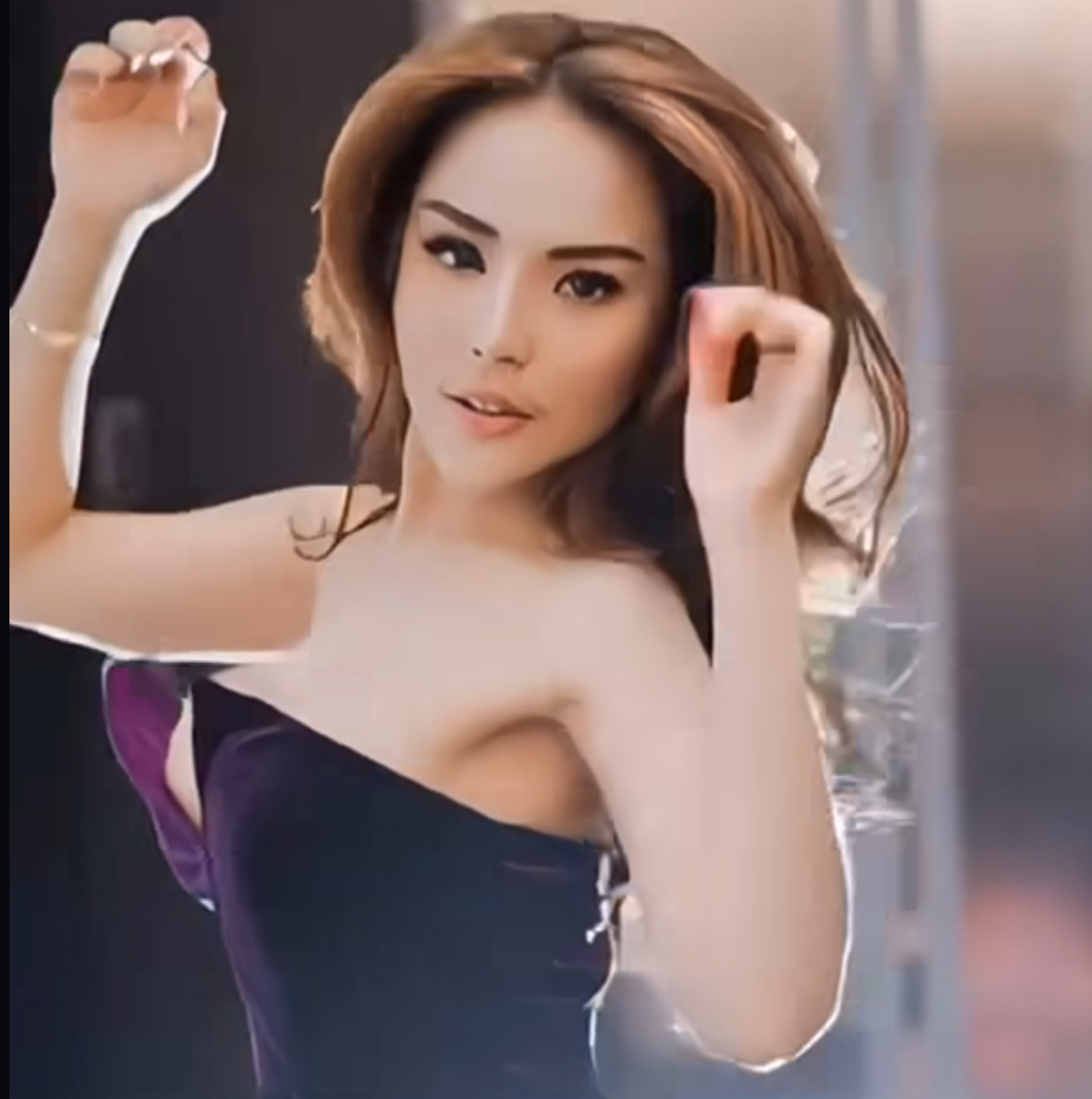 Jalani Operasi Bariatrik di Malaysia, Biaya yang Dikeluarkan Lisa Mariana Tembus Rp90 Juta