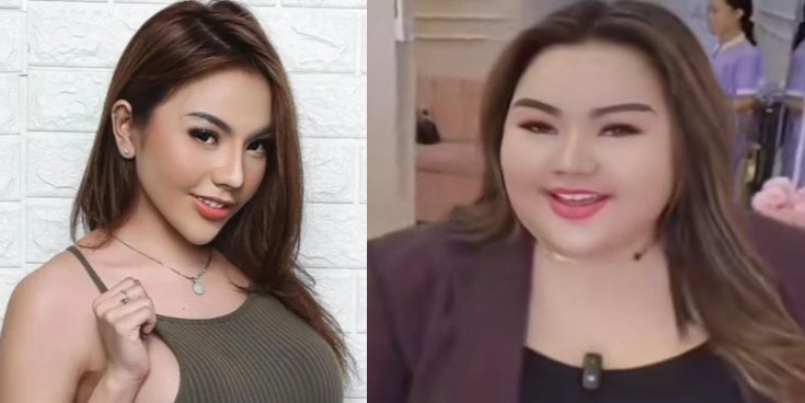 Lisa Mariana Jalani Operasi Potong Lambung, Demi Apa Sih?