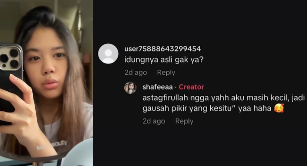 Dituding Operasi Hidung, Shafeea Ahmad Malah Beri Jawaban yang Bikin Netizen Melongo!