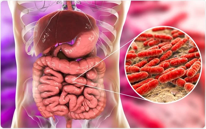 Sakit Perut Terus-Terusan di Bagian Kiri? Bisa Jadi Ulcerative Colitis!