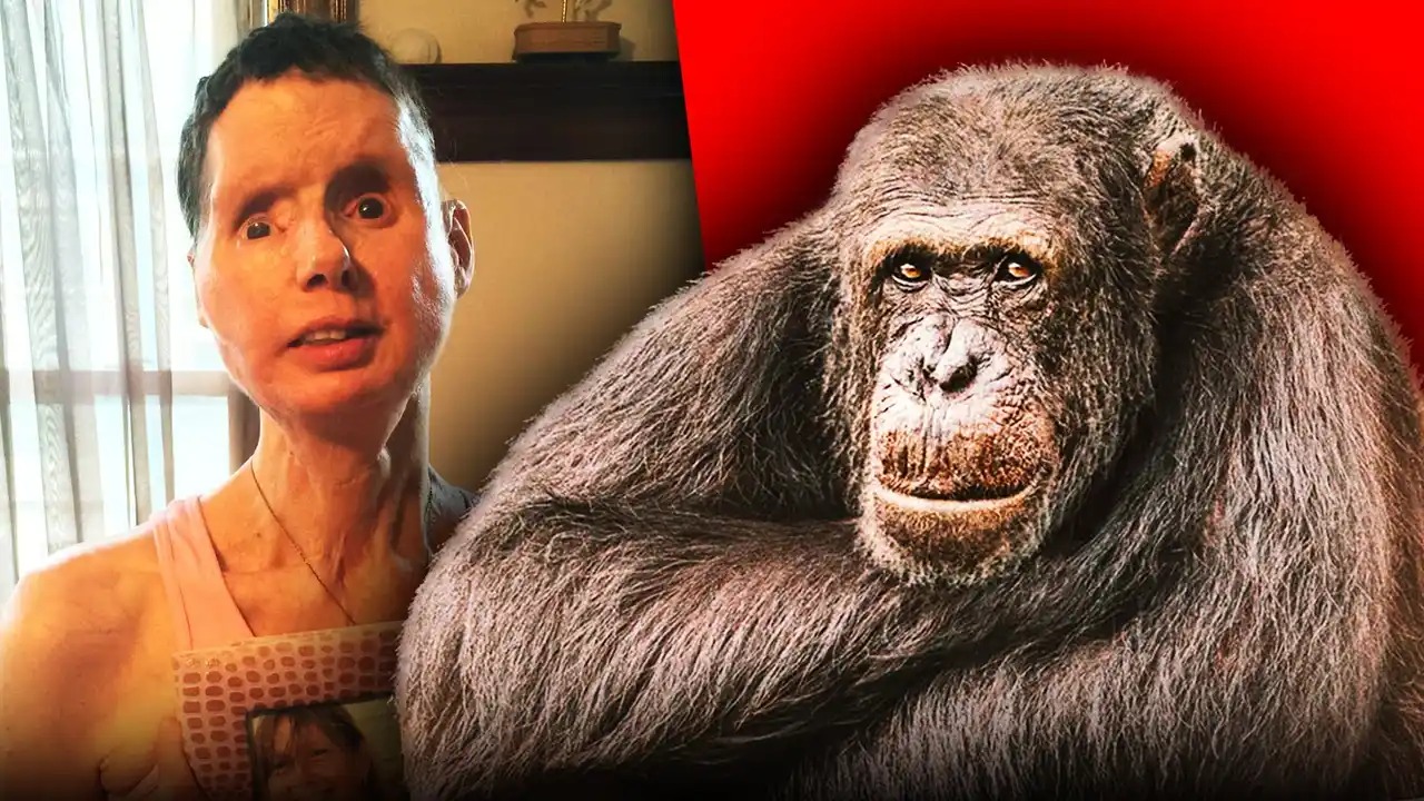Ngeri! Diserang Simpanse Sahabat, Wajah Hancur dan Buta Selamanya, Charla Nash Masih Dihantui Trauma 16 Tahun Lalu