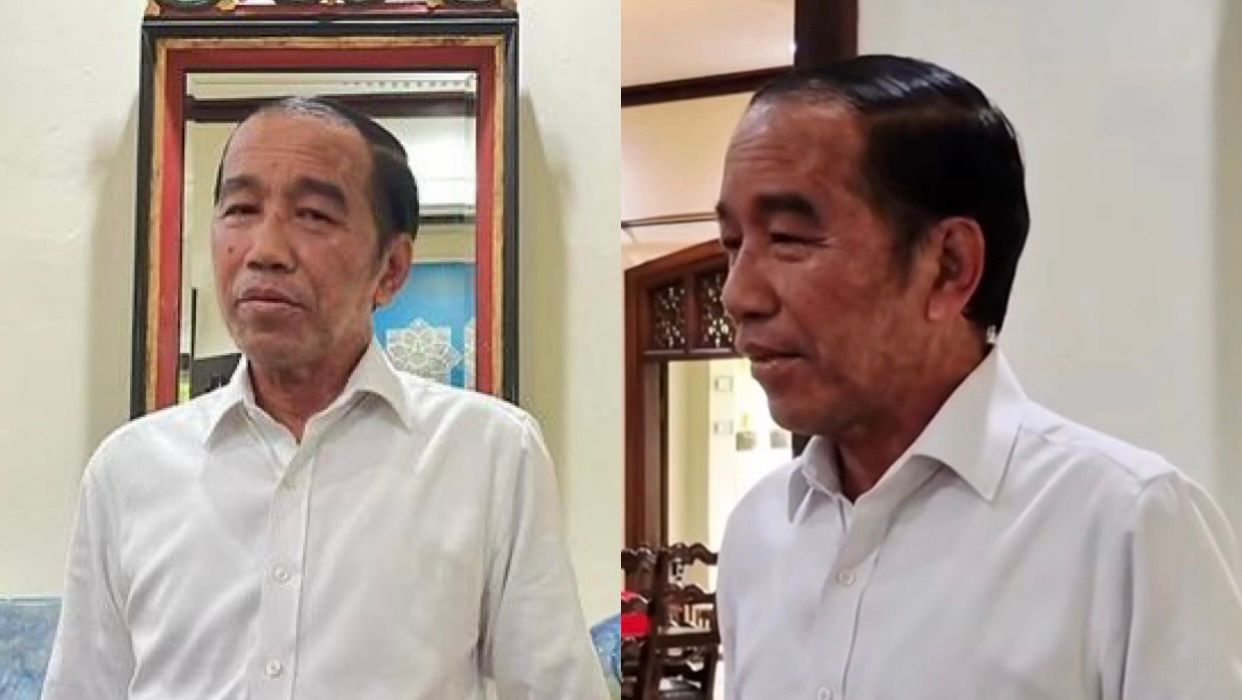 Kondisi Kulit Jokowi Jadi S...