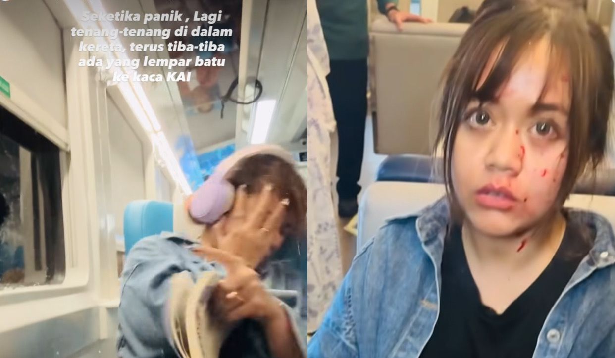 Detik Detik Wanita Luka Par...