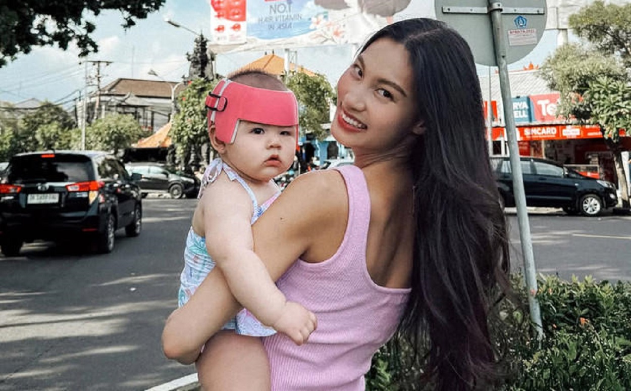 Anak Patricia Gouw Alami Ke...