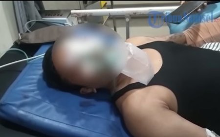 Pengantin Pria Diserang dan Dihantam Senjata Saat Akan Akad Nikah