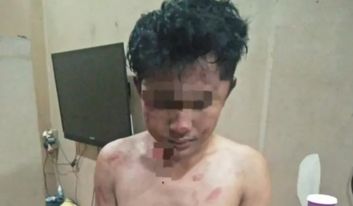 salah satu korban insiden pembacokan di cungking banyuwangi