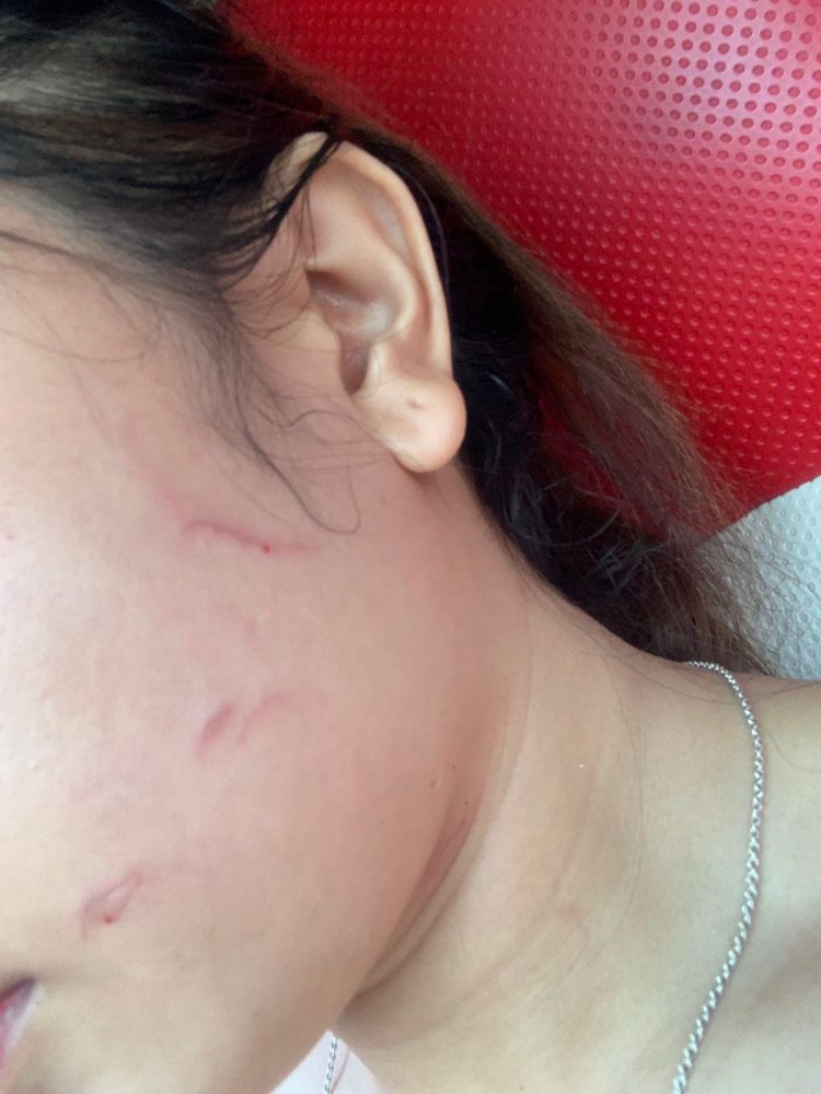 Korban memperlihatkan luka lebam setelah dikeroyok