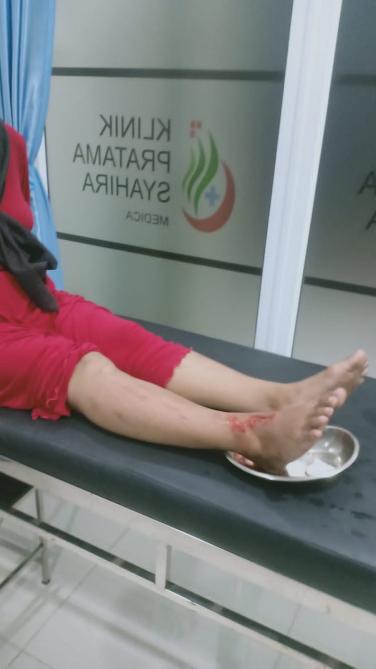 Ita (42) mengalami luka di kaki dan terasa sakit di bagian pinggangnya